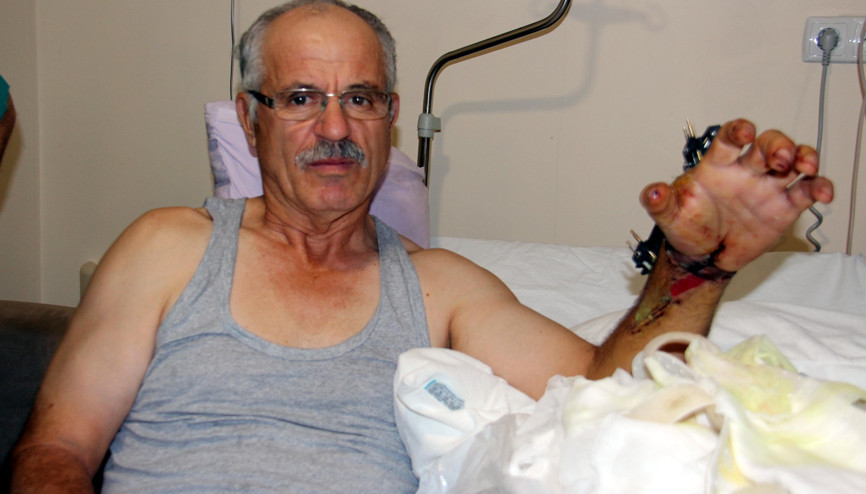 Elini kesti, hiç acı hissetmedi Elini kesti, hiç acı hissetmedi