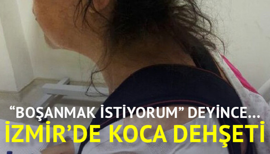 Boşanmak istediği eşinin silahlı saldırısına uğradı