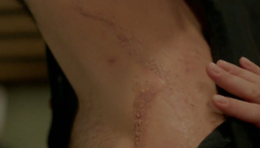 Ayşegül, Poyrazın yaralarını görüyor