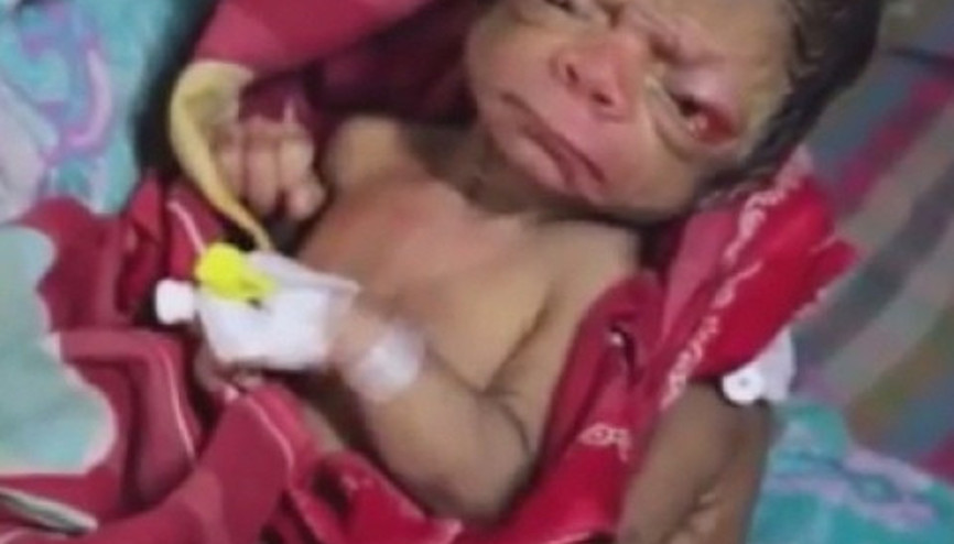 Gerçek Benjamin Button doğdu