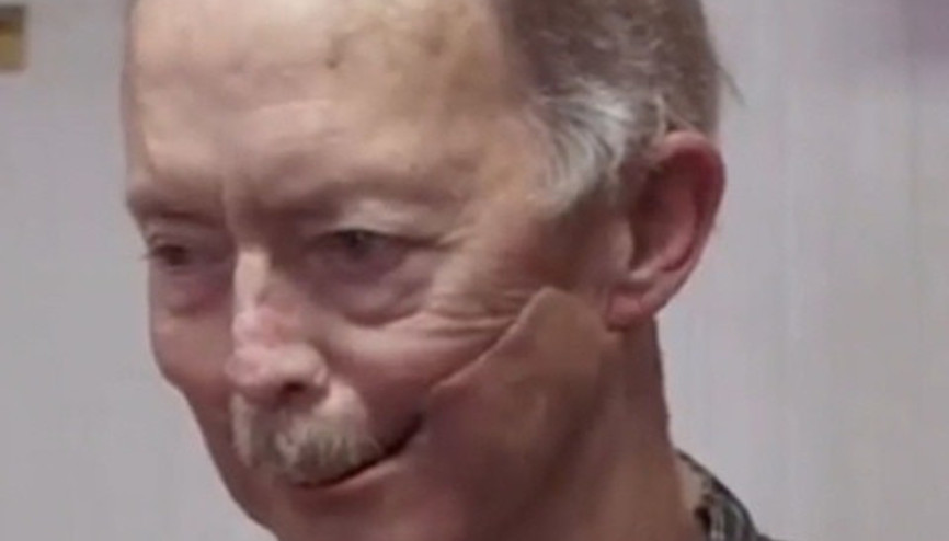 Yaşlı adam 3 boyutlu yazıcı sayesinde silikon çenesine kavuştu