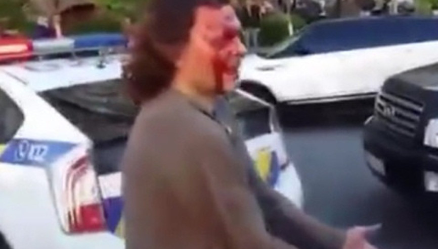 Eski güreşçiyi 7 polis zor durdurdu