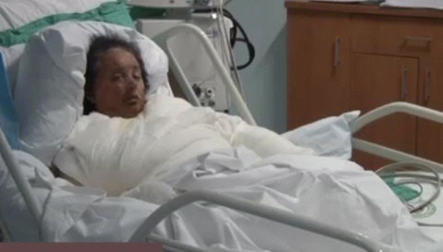 20 yıllık eşini uykusunda kaynar suyla yaktı