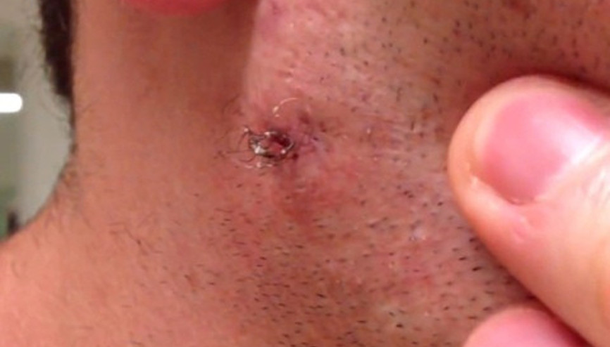 Gelmiş geçmiş en uzun kıl dönmesi