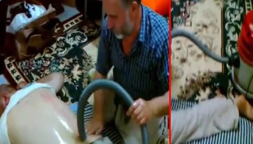 Elektrik süpürgesi ile bel fıtığı tedavisi