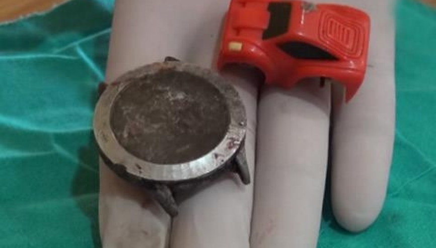 YEMEK BORUSUNDAN KOL SAATİ ÇIKTI