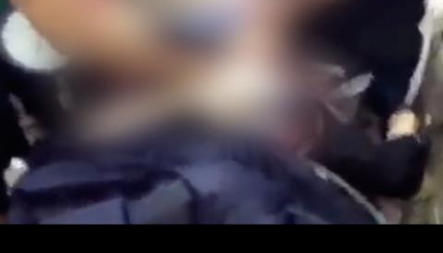 MISIRDA ÖLDÜRÜLEN ESMANIN HASTANE GÖRÜNTÜLERİ