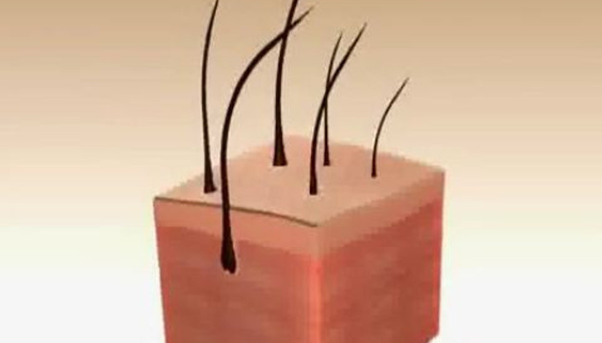 Saç Dökülmesi Nasıl ve Neden Meydana Gelir