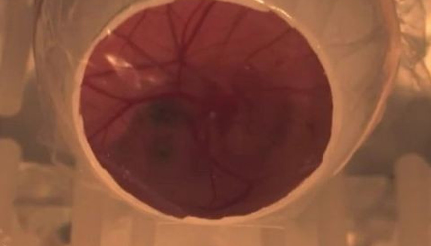 Yaşayan 13 Günlük Embriyo