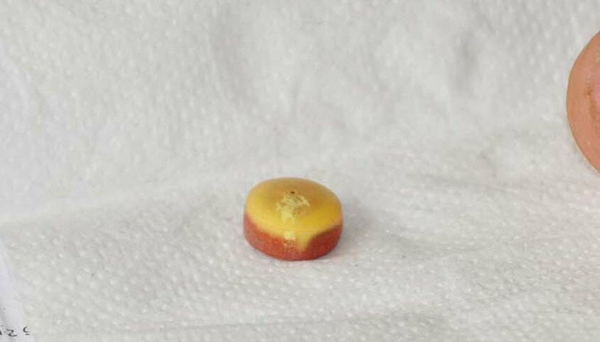 Tansiyon ilacı plastik çıktı Tansiyon ilacı plastik çıktı