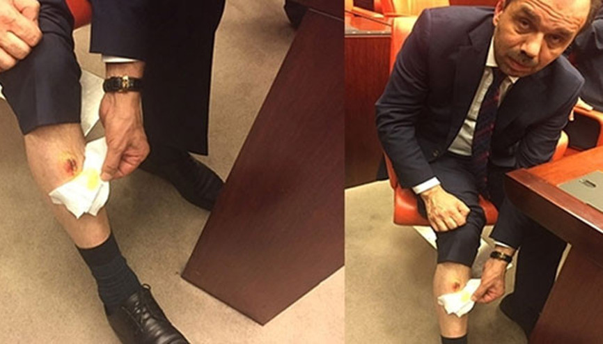 Meclisteki ısırılma olayıyla ilgili soruşturma başlatıldı