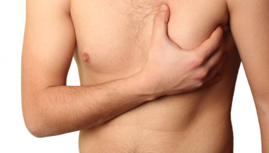 Doktor Bu Ne | Jinekomasti nedir Nasıl tedavi edilir