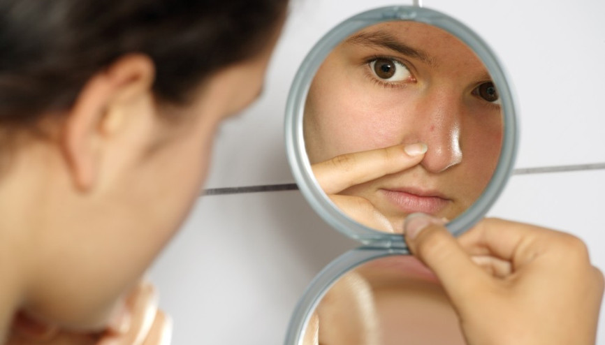 Sivilcelerinizden doğal yöntemlerle kurtulun