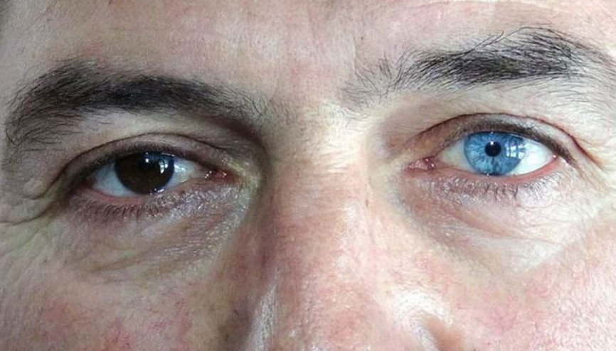 Gözleri başına bela oldu.. Hasta olmadığına polisi inandıramıyor...