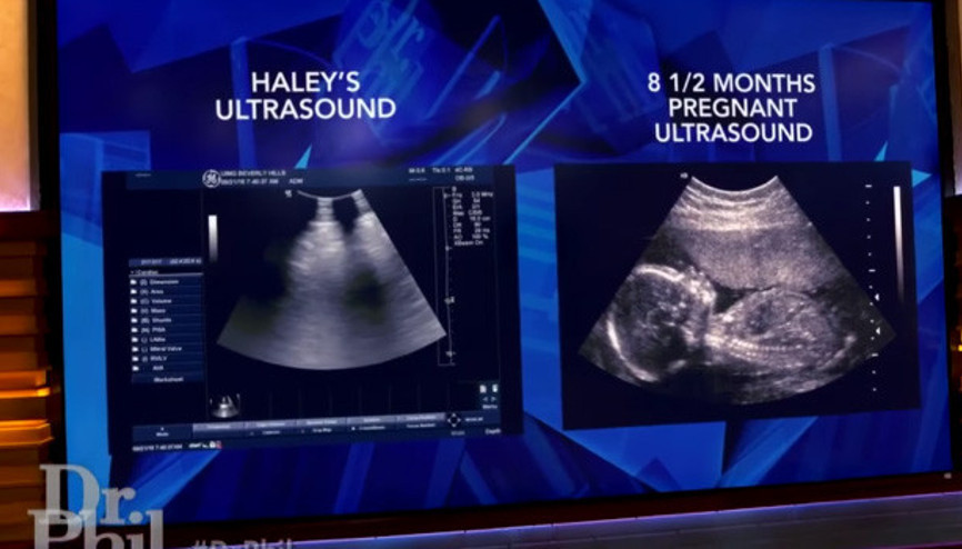 Doğaüstü Hamilelik İddialarından Bakın Ne Çıktı