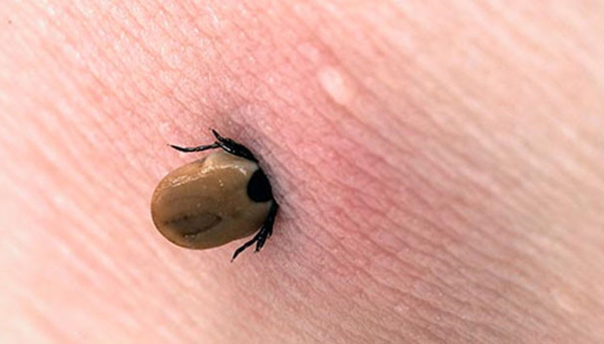 Lyme hastalığı nedir Lyme hastalığı belirtileri nelerdir