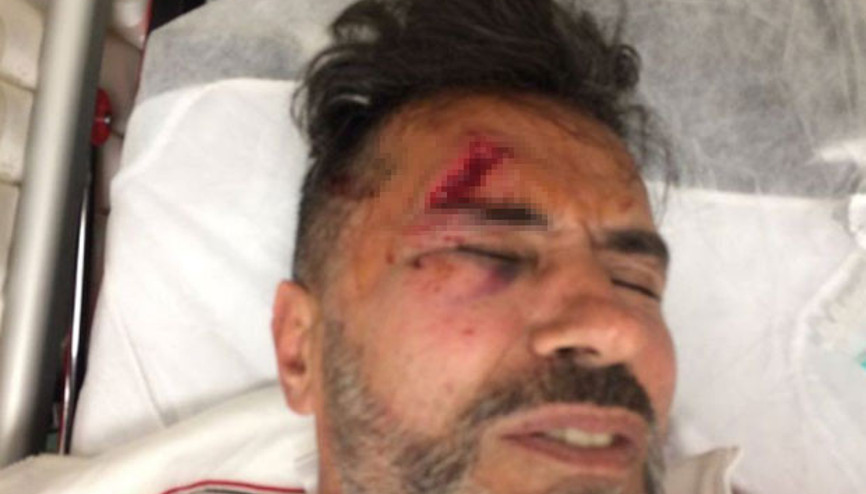 Yaşar Alptekin kaza geçirdi