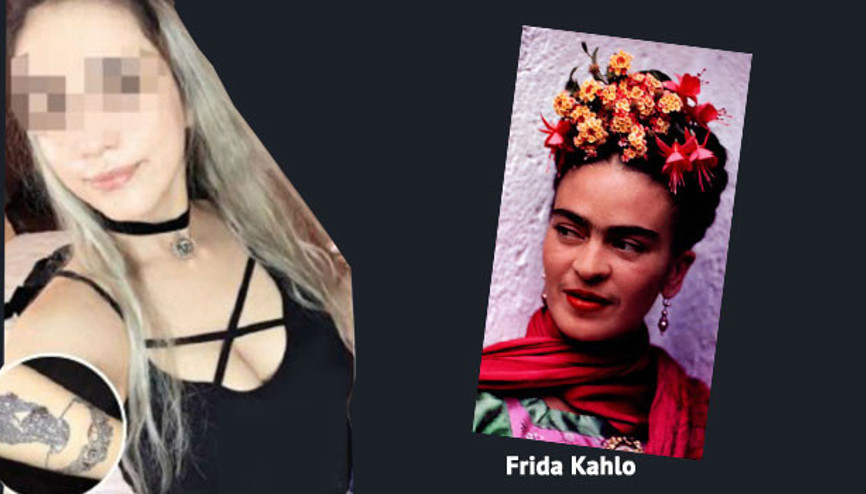 Lazer epilasyonda Fridasını kaybetti