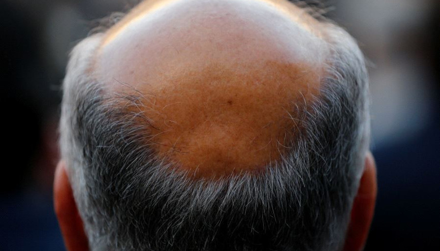 Mozambikte kel avı Polis alarma geçti