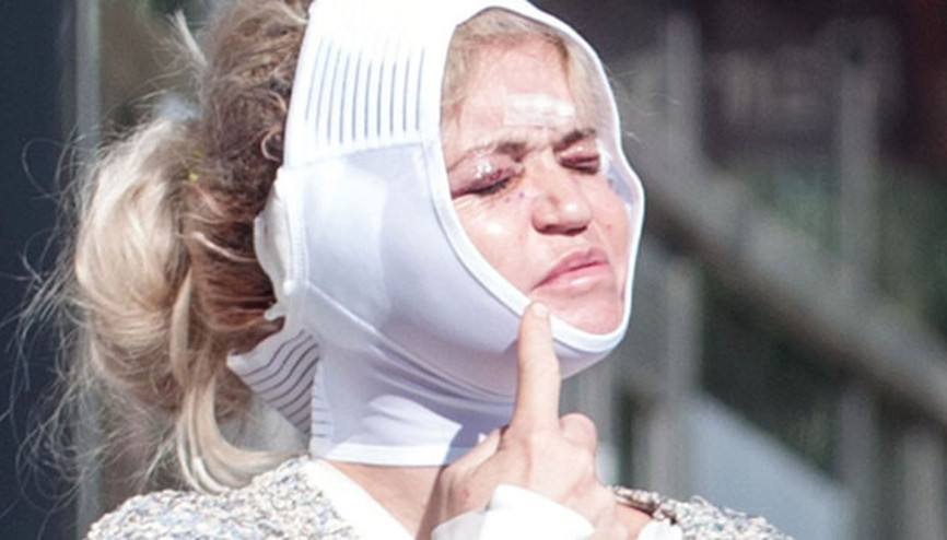 Estetik bağımlısı yıldız: Çektiğim acıya değmedi, pişmanım