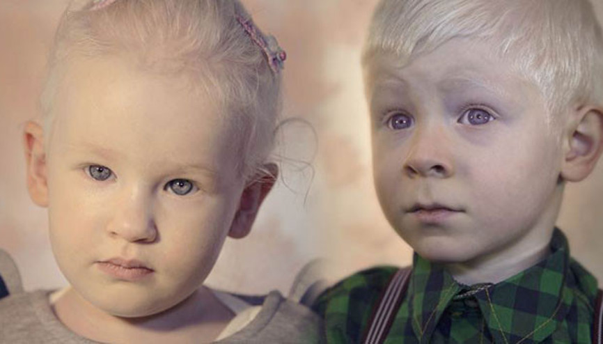 Türkiye’nin beyaz melekleri Albinolar