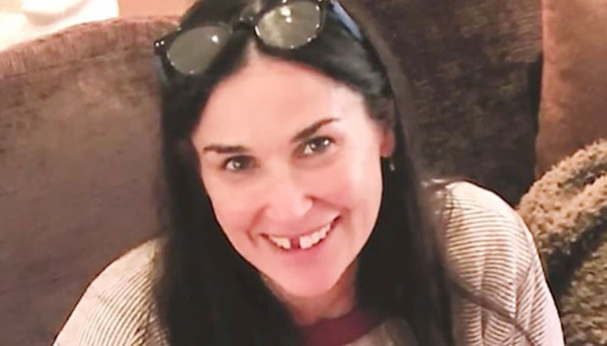 Stresten dişlerim döküldü