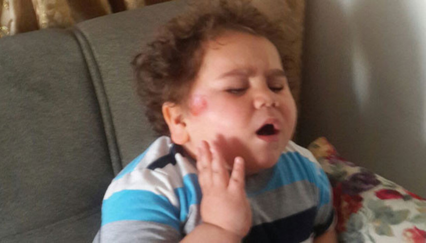 Çitos Efe’ye nazar değdi, trafik kazasında yaralandı