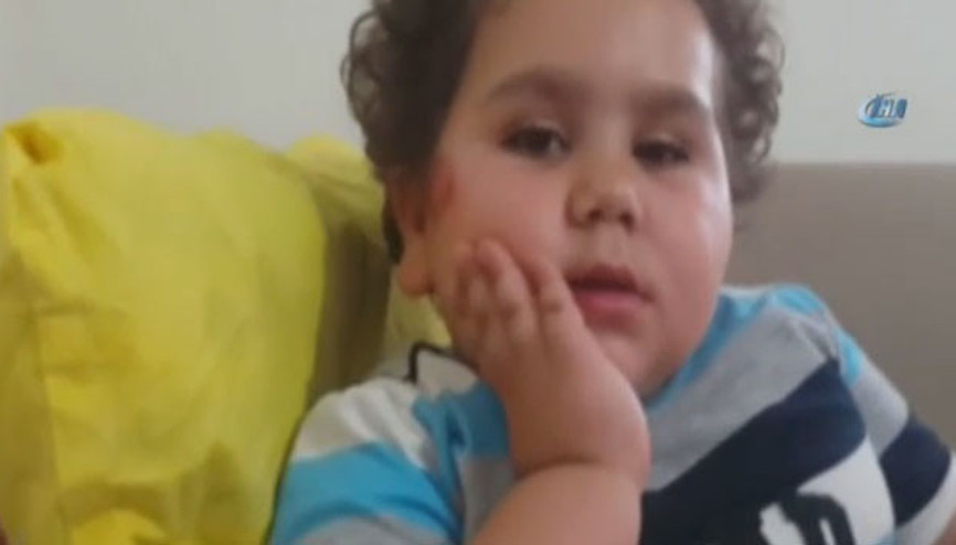 Çitos Efe’ye nazar değdi