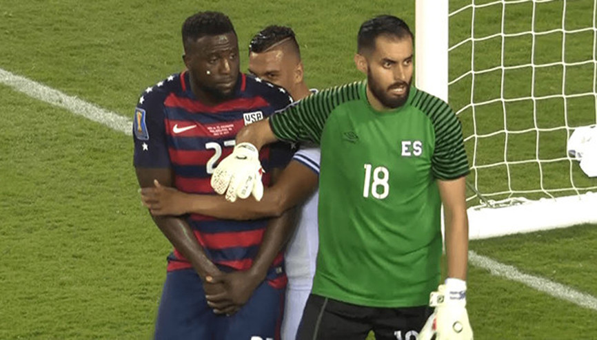 Yeni bir ısırık vakası