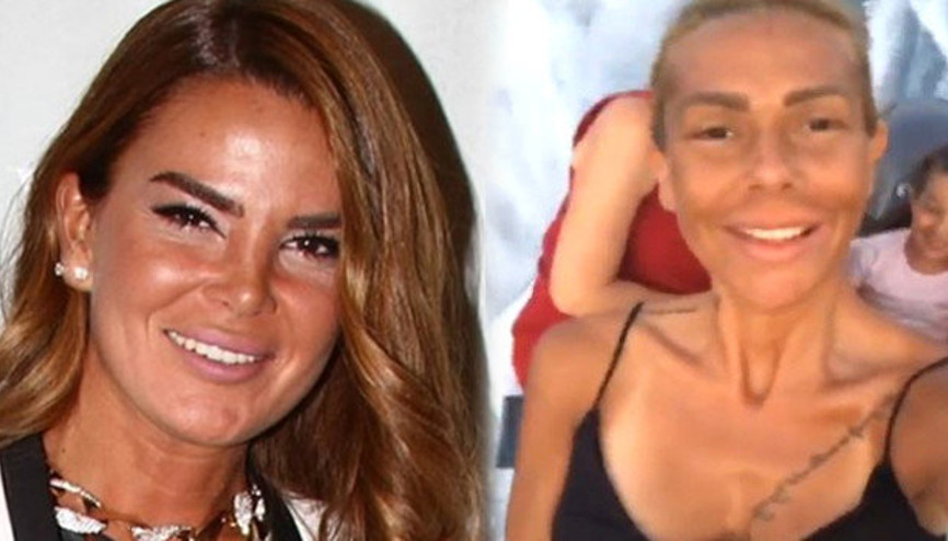 Gerizekalılık bir ömür sürer