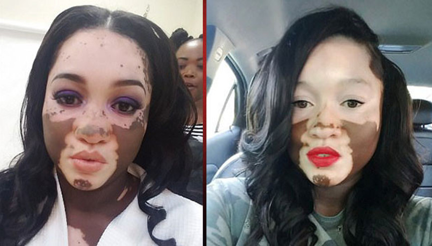 Acımasız sözlere maruz kalıyordu... Şimdi ünlü markalar peşinden koşuyor