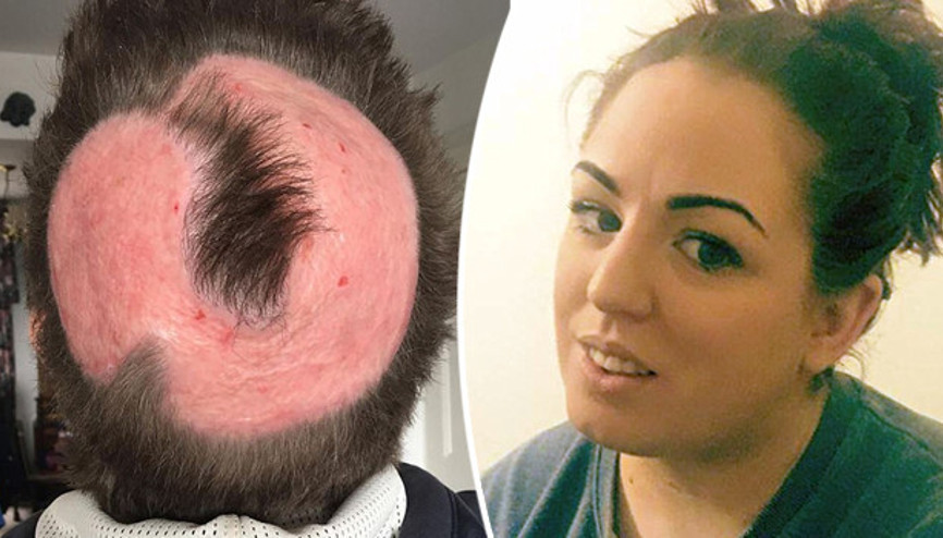 Tek isteği saçını boyamaktı... Bu hale geldi