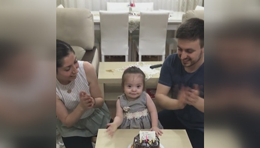 Down sendromlu bebeğin doğum günü sevinci