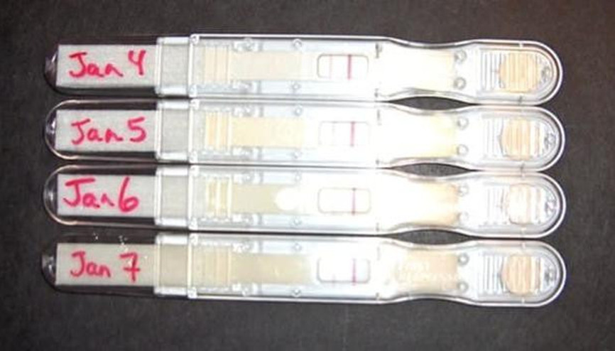 Korkunç gerçeği 7 gebelik testinin ardından öğrendi