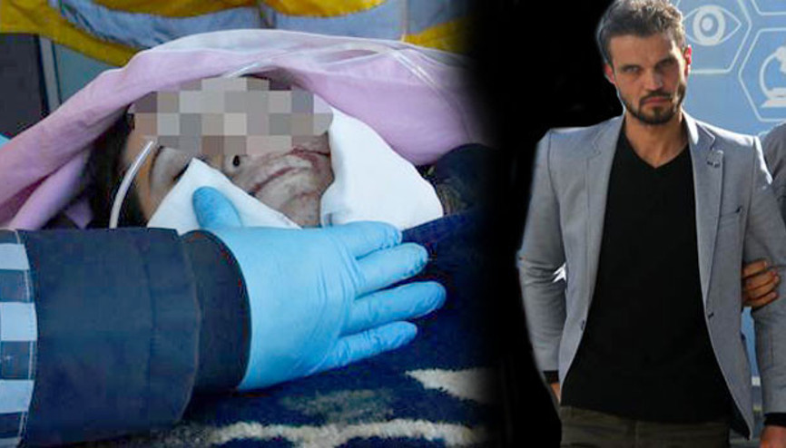 Cani koca Yanağına çarpı işareti attı