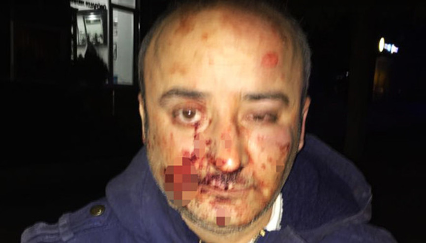 Öğrenci velisi ve yakınları öğretmeni dövdü, boyun kemiğini kırdı Öğrenci velisi ve yakınları öğretmeni dövdü, boyun kemiğini kırdı