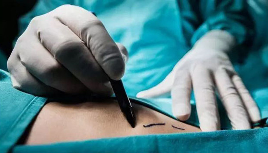 Uluslararası organ ticareti davasında Türk doktorları şoke eden iddianame