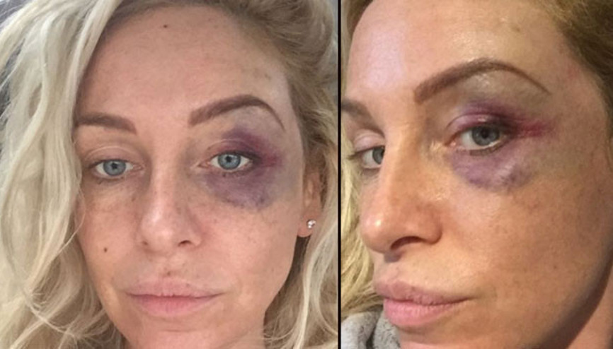 Ünlü yıldızı takside darp ettiler