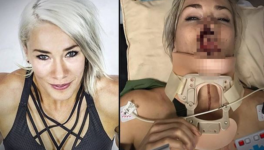 Ünlü dağ bisikletçisi kaza geçirdi