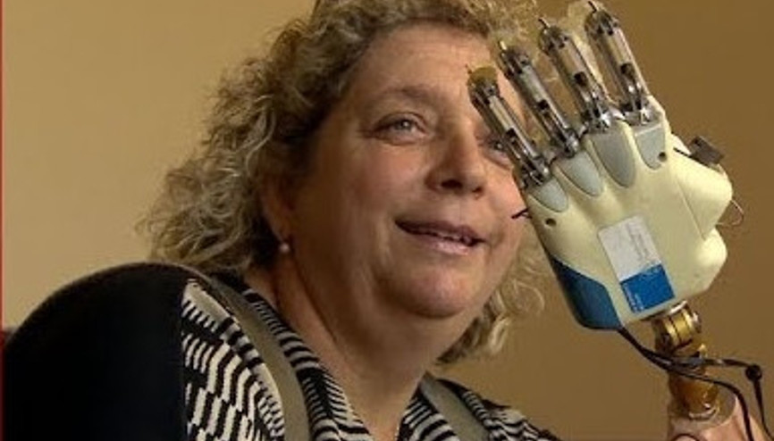 Hisleri iletebilen ilk taşınabilir biyonik el geliştirildi