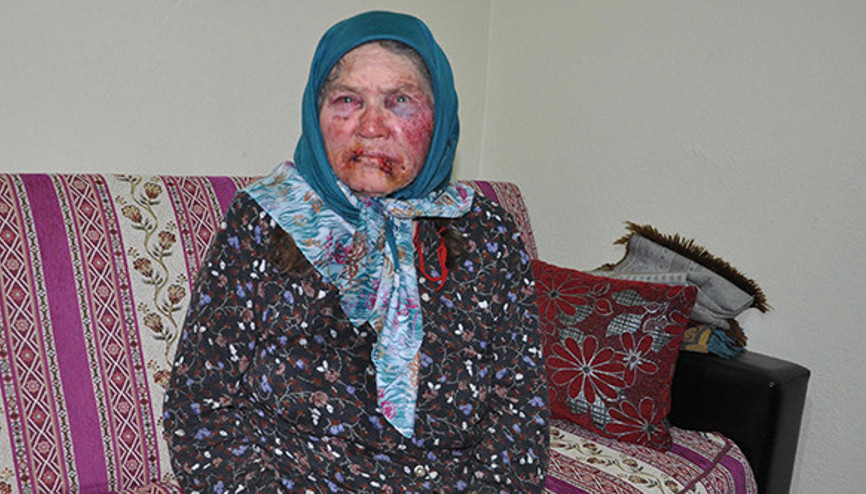 Bu hale getirip gasp etmişlerdi Gözaltına alınan kişi şoke etti