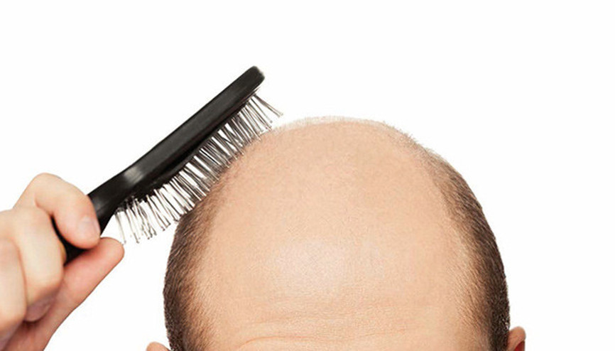 Kelliğe Japon çözümü