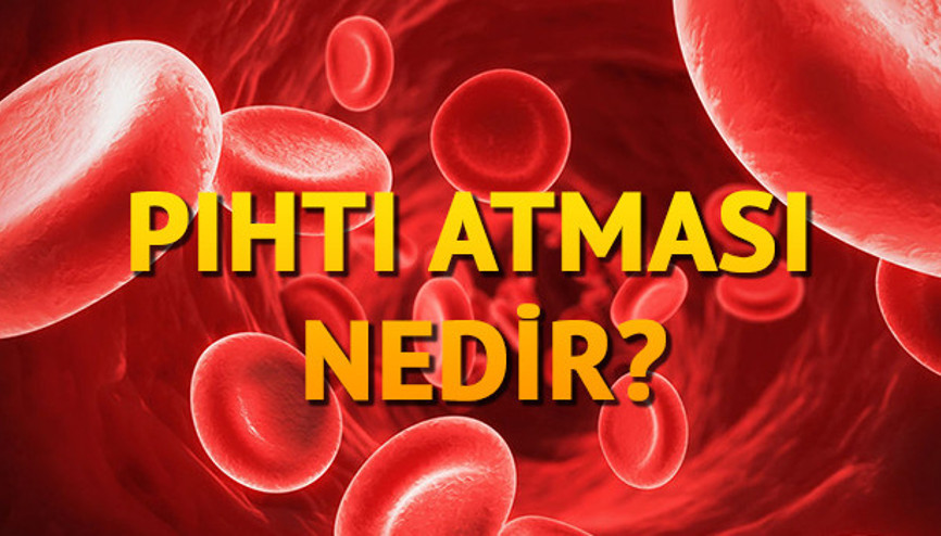 Pıhtı atması nedir Beyne pıhtı atması nasıl olur