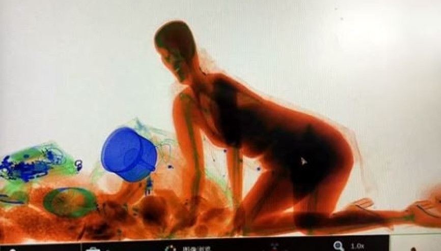 Parasını çaldırmaktan korkan Çinli kadın X-ray cihazının içine girdi