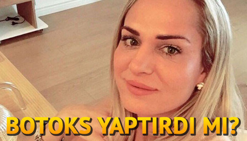 Nagihan Karadere kimdir Survivor Nagihan botoks mu yaptırdı