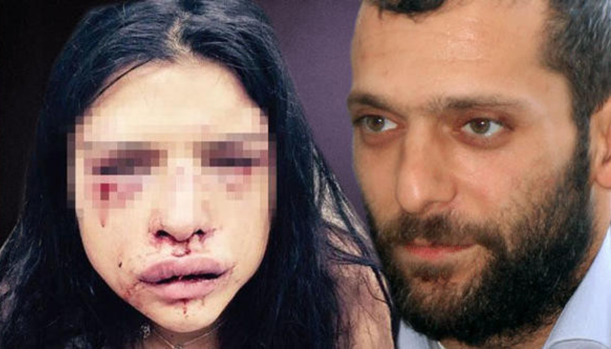 Onur Özbizerdikin hapis cezası onandı