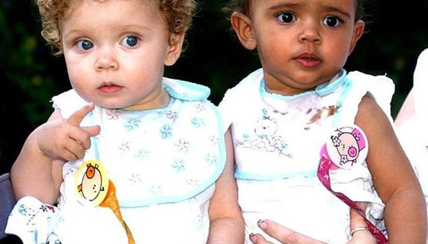 İkizleri kapağa taşıyıp özür dilediler