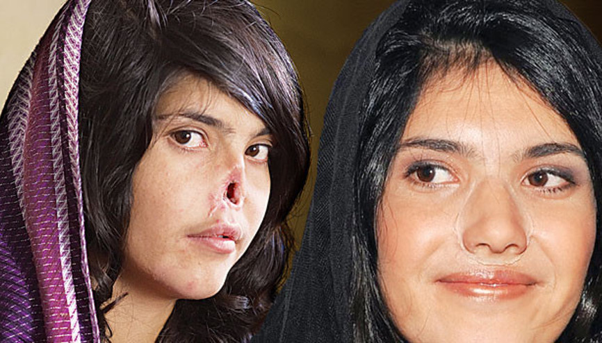 Bir fotoğrafla hayatı değişti