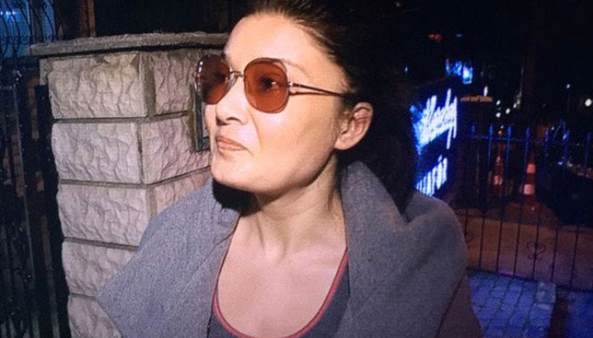 Nurgül Yeşilçay yine mi estetik yaptırdı