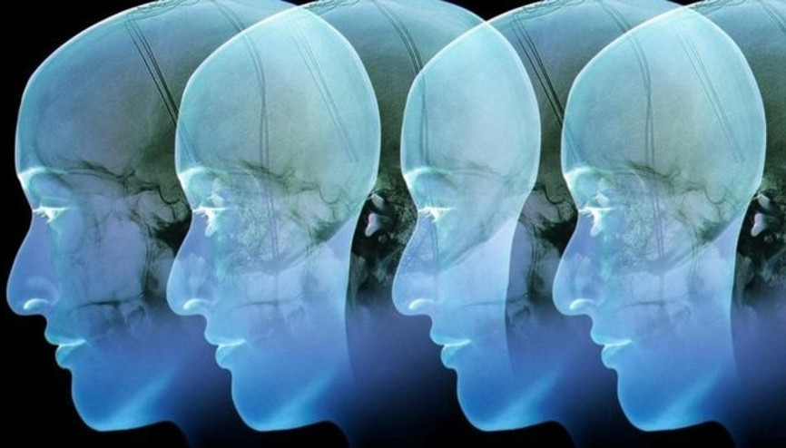 Beyin elektrotu yoluyla depresyon ve obezite tedavisi